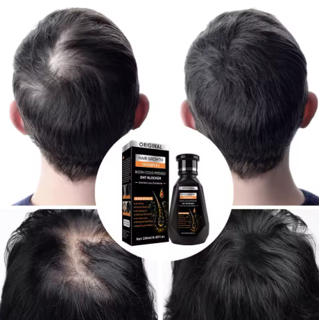 CHAMPÚ PARA EL CRECIMIENTO DEL CABELLO  JENGIBRE CON BIOTINA