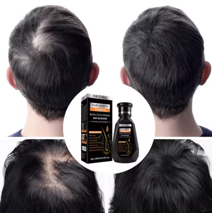 CHAMPÚ PARA EL CRECIMIENTO DEL CABELLO  JENGIBRE CON BIOTINA